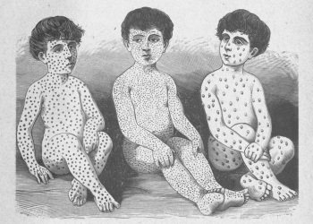 Мальчики с симптомами трех недугов
