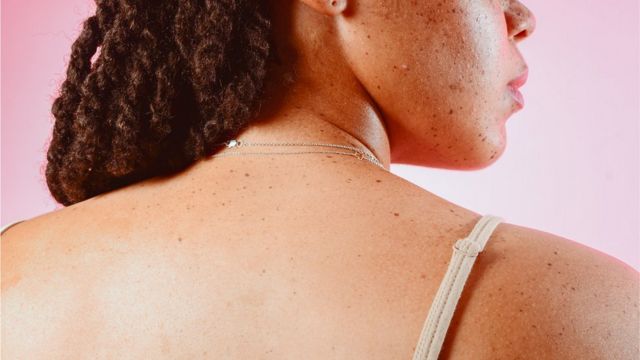 Шампуни разрушают микро-экосистемы на нашей коже